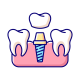 dental-implant (1)